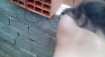 సన్బర్న్ మార్కులు